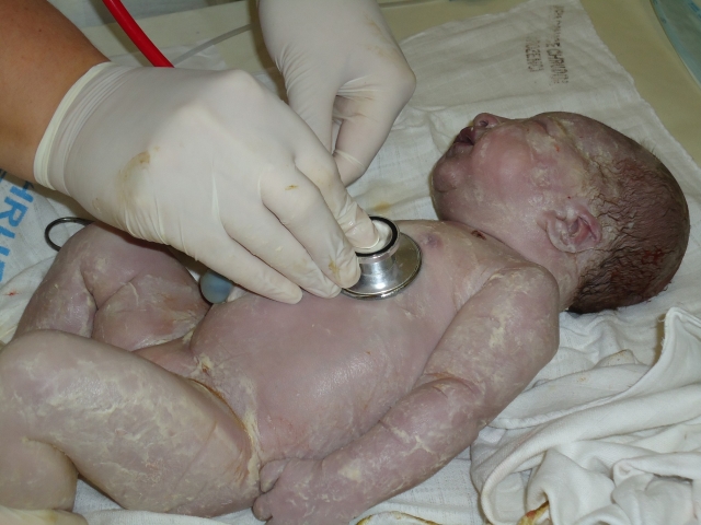 ještě jsem slizounek